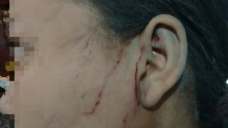 Dikeroyok, Siswi SMP di Belawan Luka-luka, Pelaku : Kami Udah Bayar Polisi !