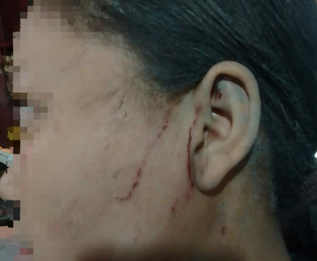 Dikeroyok, Siswi SMP di Belawan Luka-luka, Pelaku : Kami Udah Bayar Polisi !