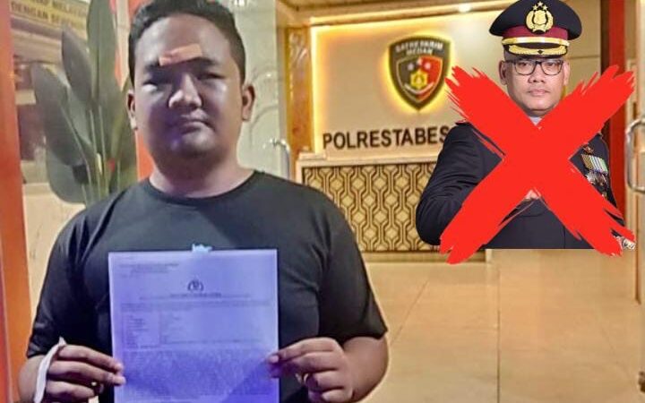 Pekan Depan, Wartawan Korban Penganiayaan Akan Gelar Aksi Unjuk Rasa Copot Kapolrestabes Medan