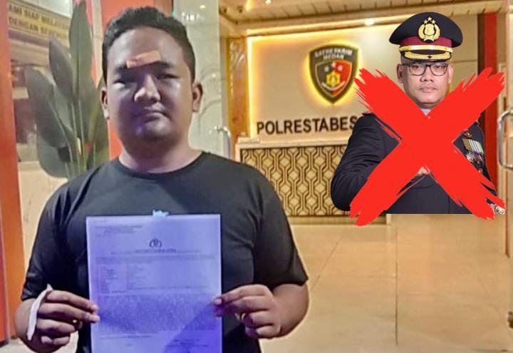Pekan Depan, Wartawan Korban Penganiayaan Akan Gelar Aksi Unjuk Rasa Copot Kapolrestabes Medan