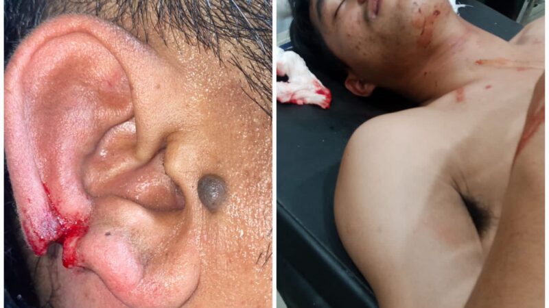 Polda Sumut Tegaskan Sikap: Meski 10 Personel Jadi Korban Luka, Penanganan Kamtibmas di Dairi Tetap Humanis